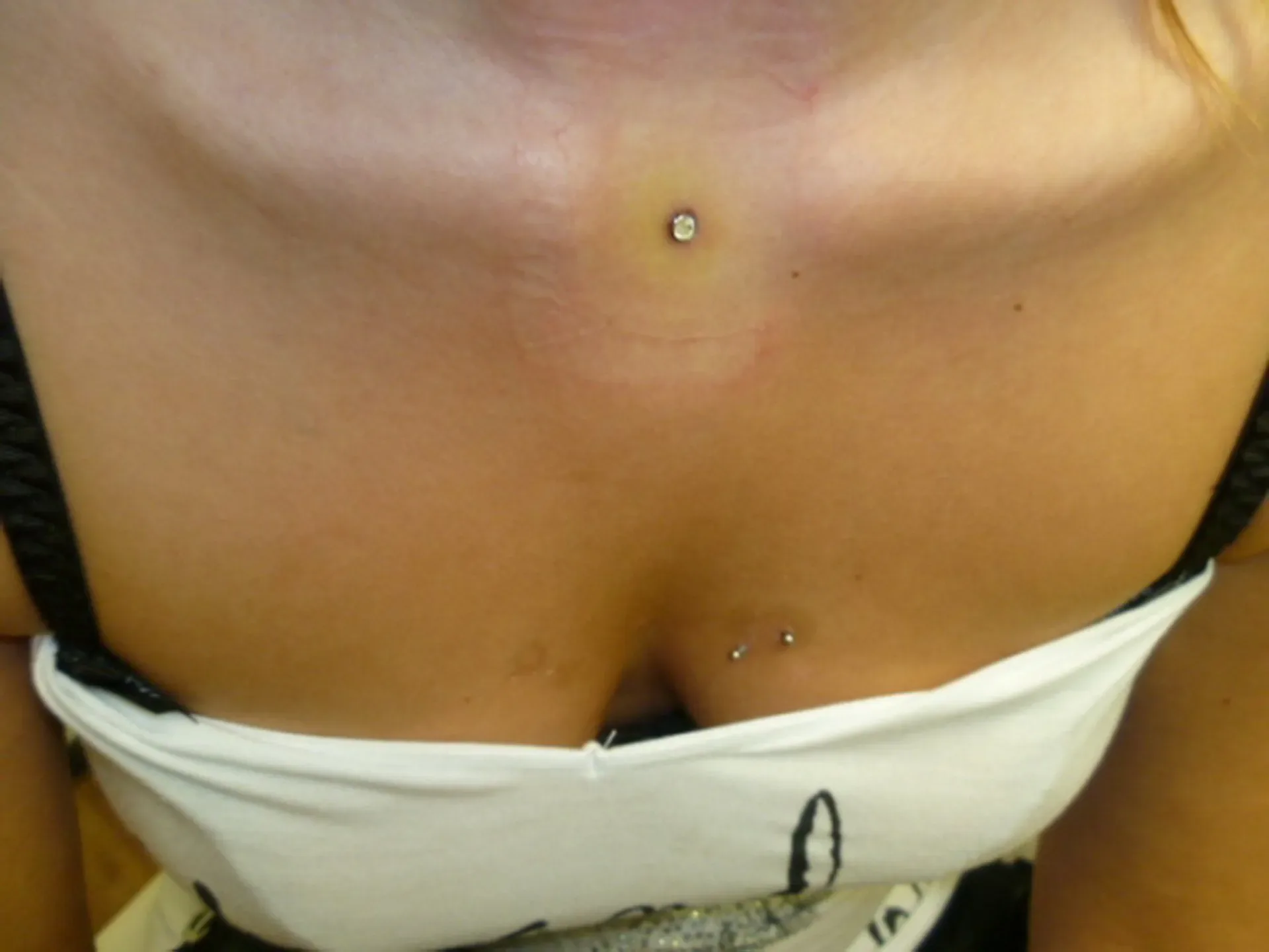 Piercing Ink Cooperation in Worms